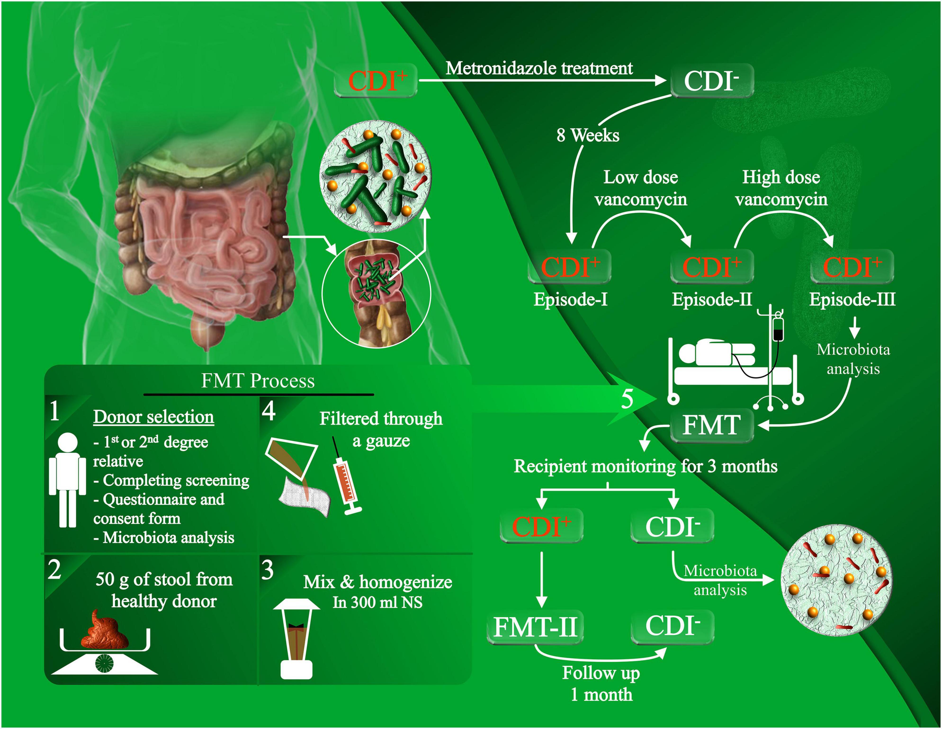 Intestinal microbiota changes pre- and post-fecal microbiota transplantation for treatment of recurrent Clostridioides difficile infection among Iranian patients with concurrent inflammatory bowel disease